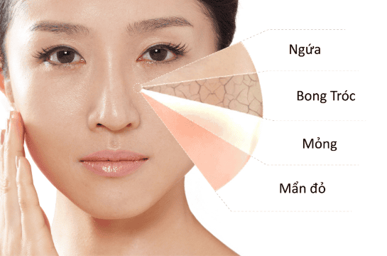 Da nhạy cảm là gì và vì sao dễ kích ứng khi dùng sữa tắm? Da nhạy cảm là gì và vì sao dễ kích ứng khi dùng sữa tắm?