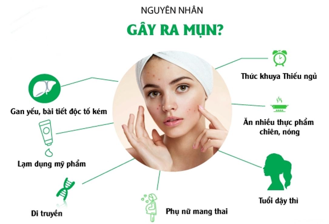 Nguyên Nhân Gây Mụn Và Cách Chăm Sóc Da Mụn Hiệu Quả Nguyên Nhân Gây Mụn Và Cách Chăm Sóc Da Mụn Hiệu Quả