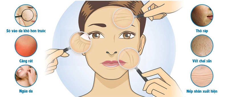 Nguyên Nhân Khiến Da Bị Khô Nguyên Nhân Khiến Da Bị Khô